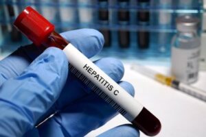 Visibilizando la hepatítis vírica