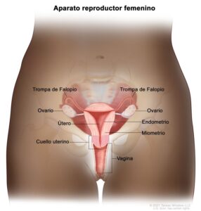 cáncer de cuello de útero