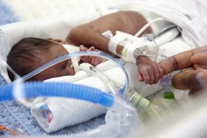 neonato