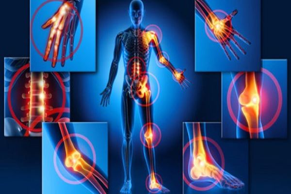 fibromialgia