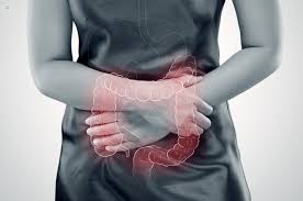 enfermedad inflamatoria intestinal