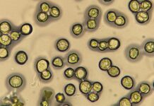 El Hospital público Ramón y Cajal implanta una cámara de exposición ambiental única en España para pacientes con alergias respiratorias polen